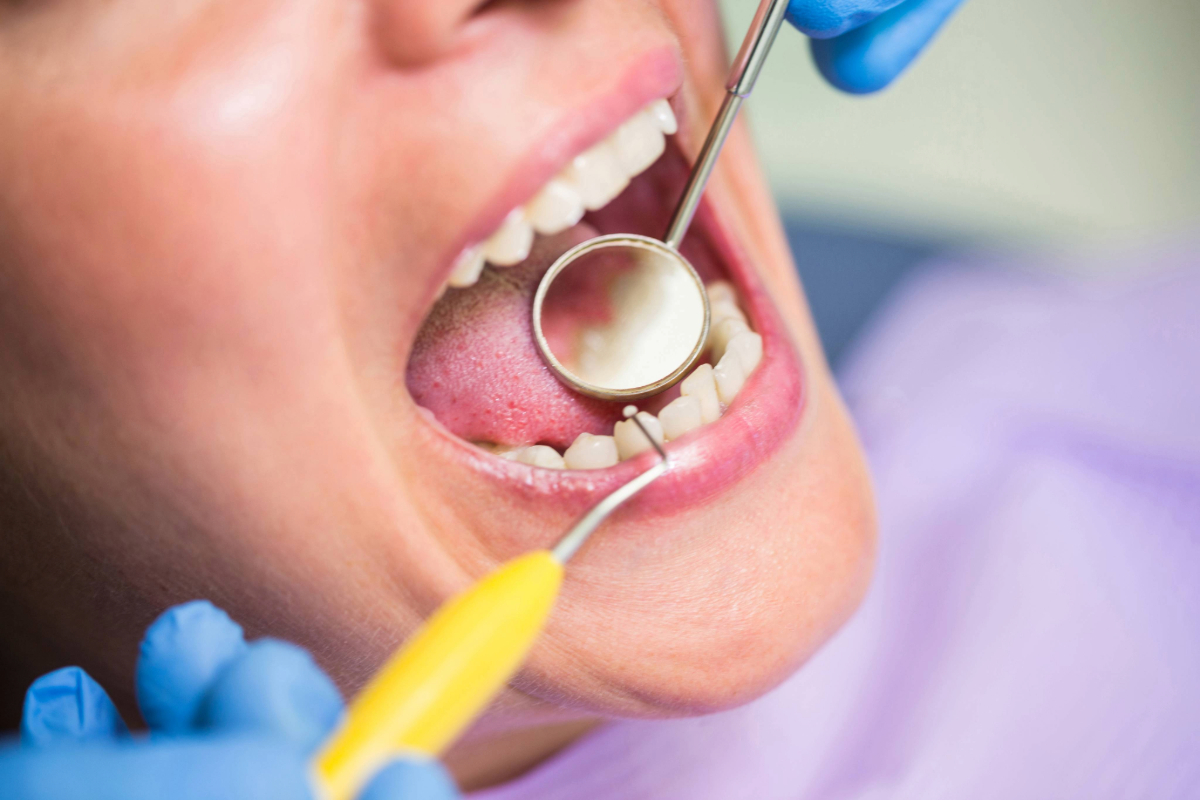 dentist-examining-female-patient-teeth (1)